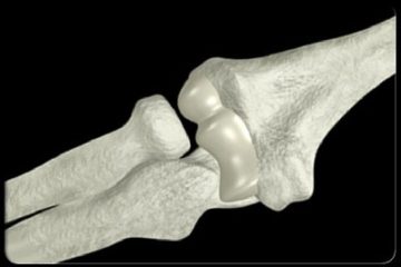 New step forward in Vietnamese biomedical materials science - Photo 2. Bước tiến mới của khoa học vật liệu y sinh Việt Nam- Ảnh 2.