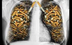 Hút thuốc lá có nguy cơ làm nặng hơn tình trạng bệnh nhân COVID-19